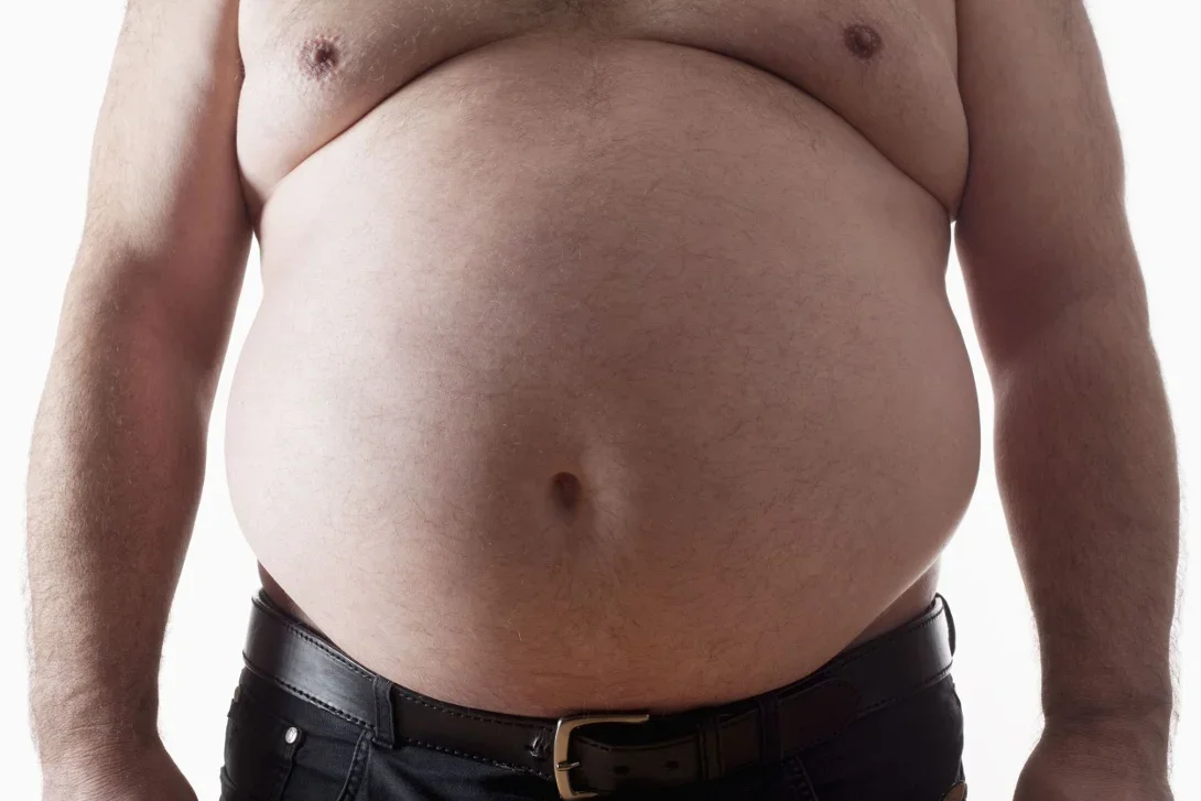   Исследователи смогли обнаружить неожиданную причину ожирения человека.