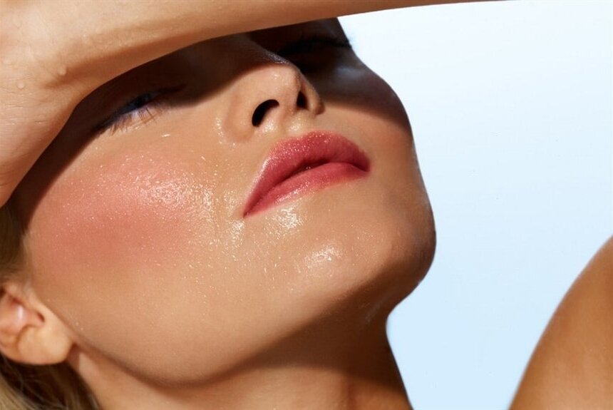 Жирная кожа