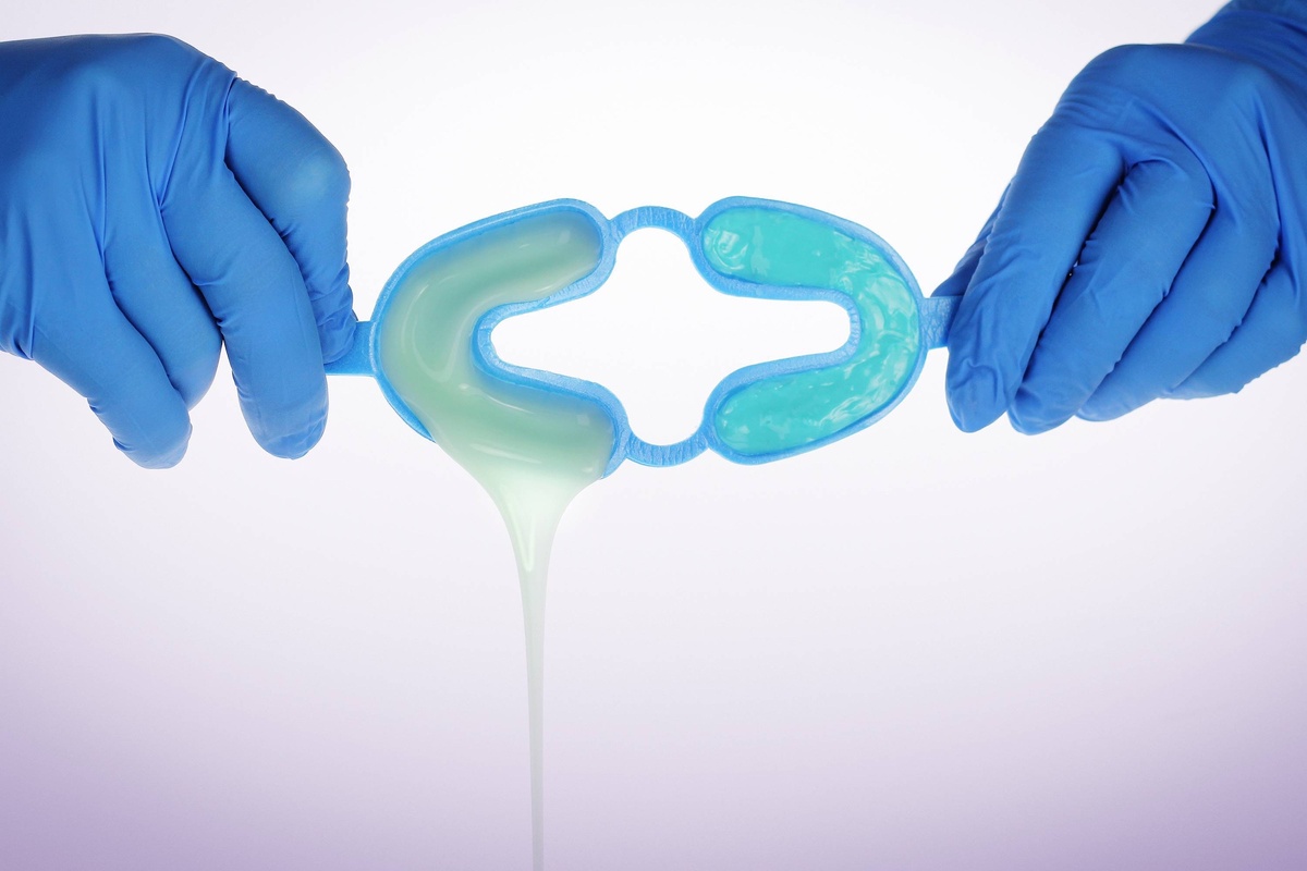 Врач вносит реминерализующий гель в универсальные каппы и засекает две-три минуты для достижения нужного эффекта