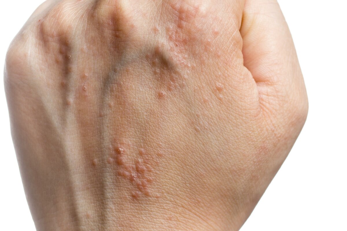 Взято из яндекс картинок. Статья из внешнего источника.