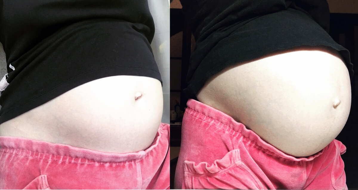 Мой животик в 4 и в 6,5  месяцев  