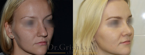 Фото с сайта хирурга Гришкяна Д.Р.