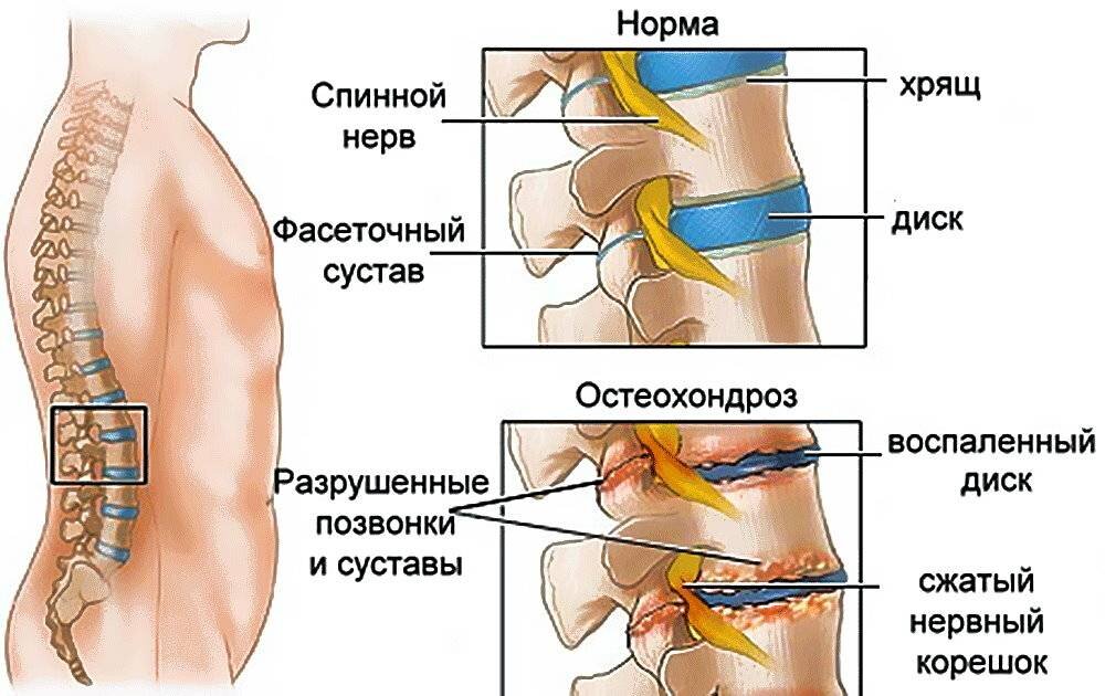 У вас болят суставы? На прием к ревматологу!