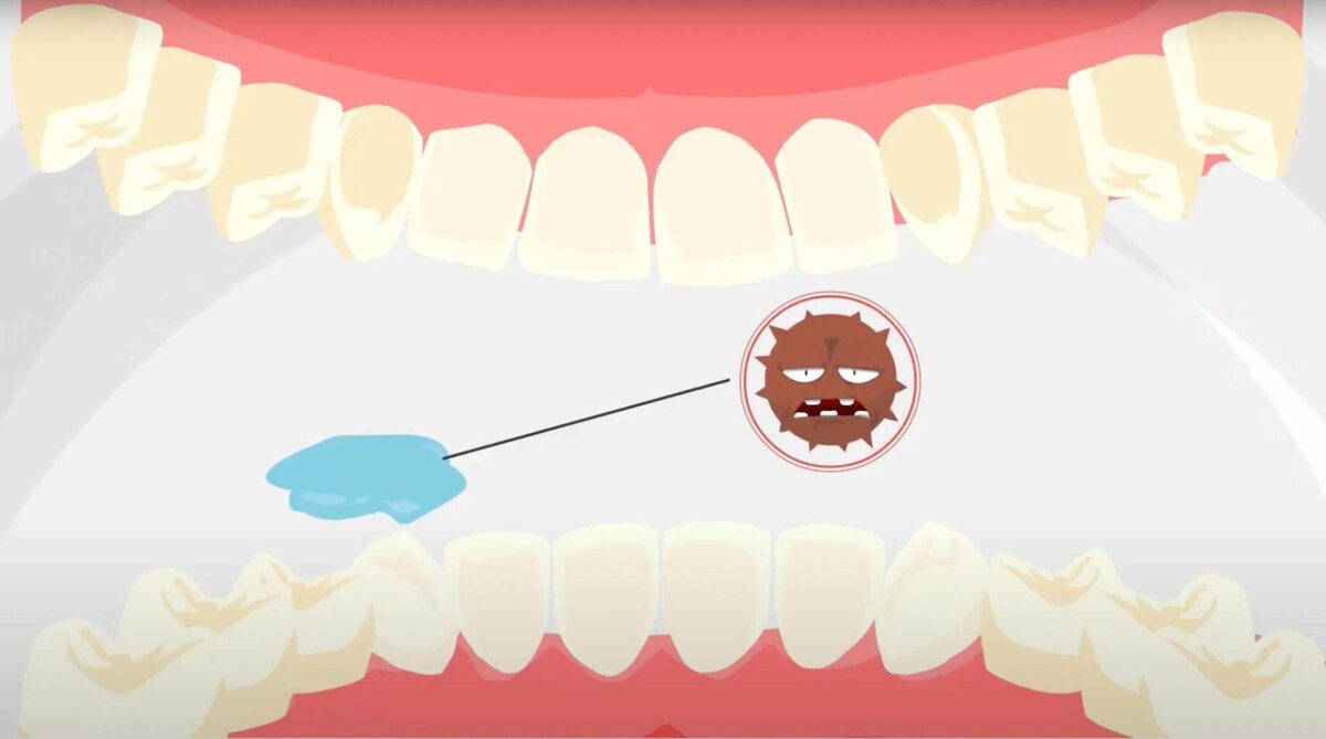 Бактерии в полости рта. Анимация от автора.