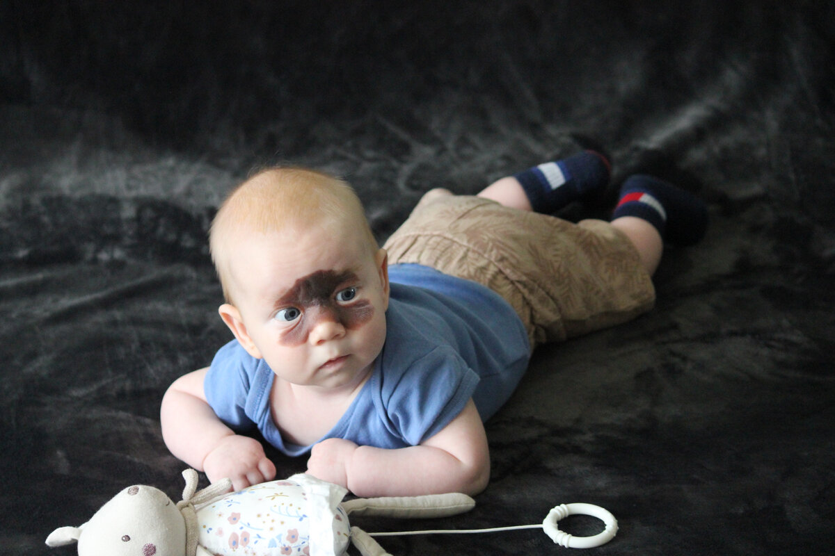 "Было тугое обвитие пуповиной. Поэтому после рождения врачи не сразу ...