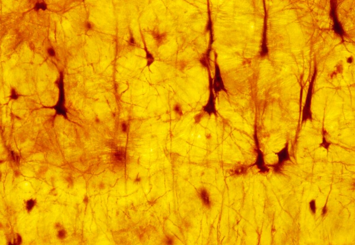 Нервные клетки коры головного мозга. Световая микрофотография среза нейронов (нервные клетки, черный цвет) в коре головного мозга человека. Ветвящиеся отростки (дендриты) получают импульсы от других нервных клеток и передают их телу клетки. У каждого клеточного тела также есть аксон, через который он передает нервные импульсы дендритам других нейронов. Нейроны позволяют получать, интерпретировать и передавать информацию по телу. Серое вещество коры головного мозга образует внешний слой мозга, который отвечает за сознательное мышление, память и язык.