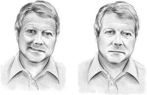 Рис.1. Центральный парез лицевой мускулатуры (центральный прозопарез)