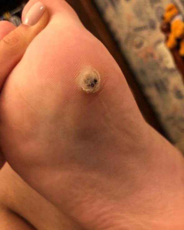 Примерно, как за неделю выросли шипы!