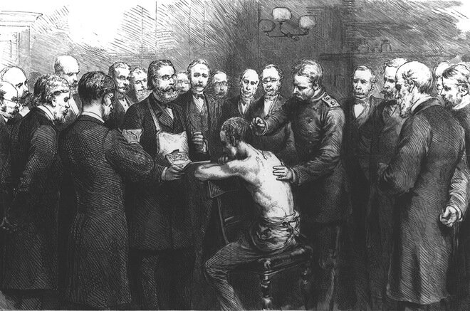 Лечение туберкулеза легких доктором Робертом Кохом. Гравюра. Англия, XIX век.                       © Bridgeman Images / Fotodom