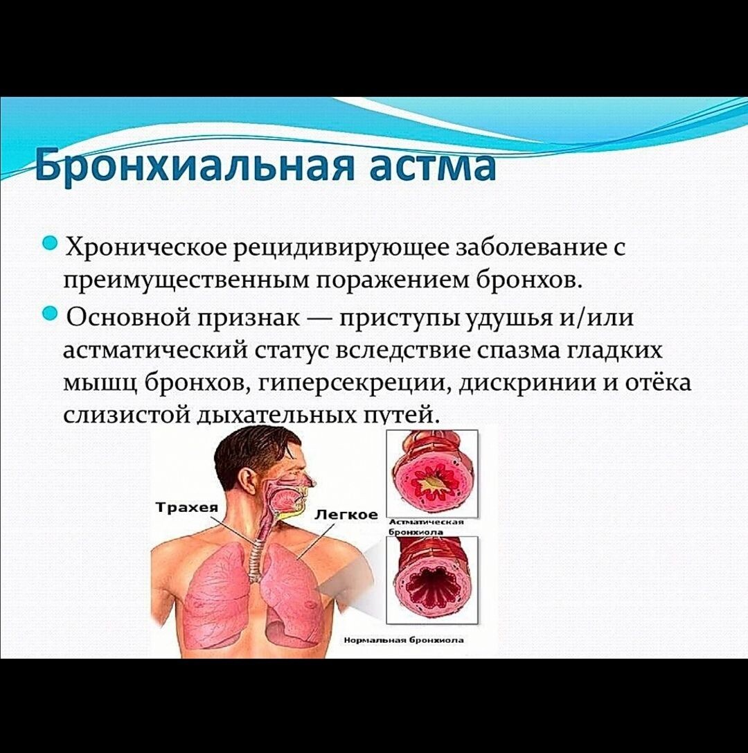Из открытых источников фото