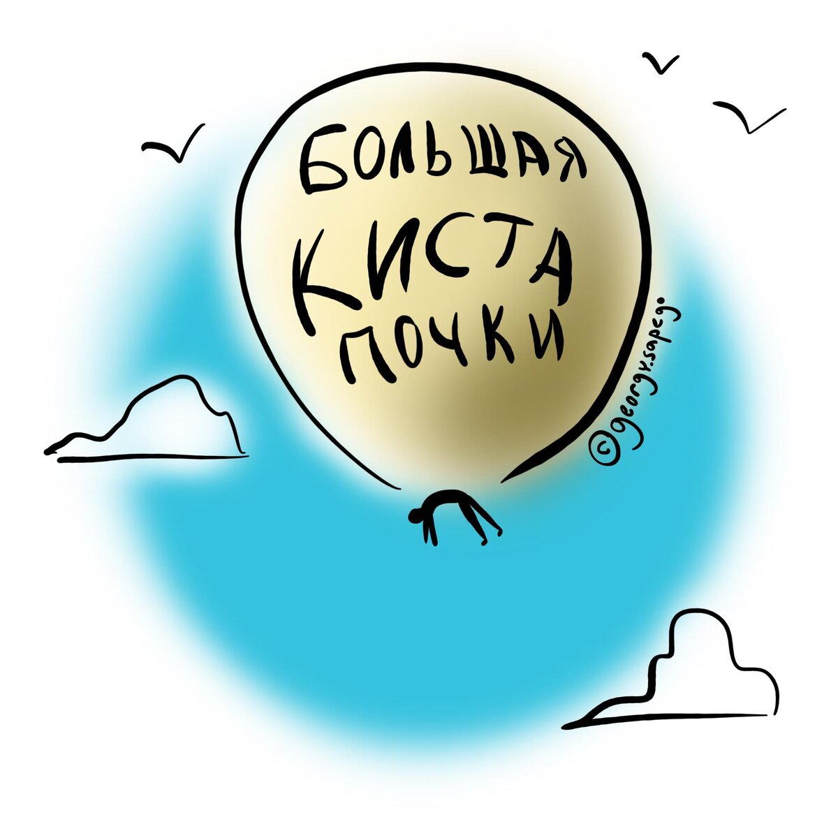 Большая киста почки