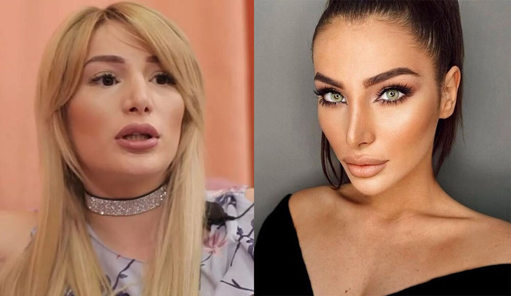 Тата блюменкранц до и после пластики Блюменкранц тата до пластики и после