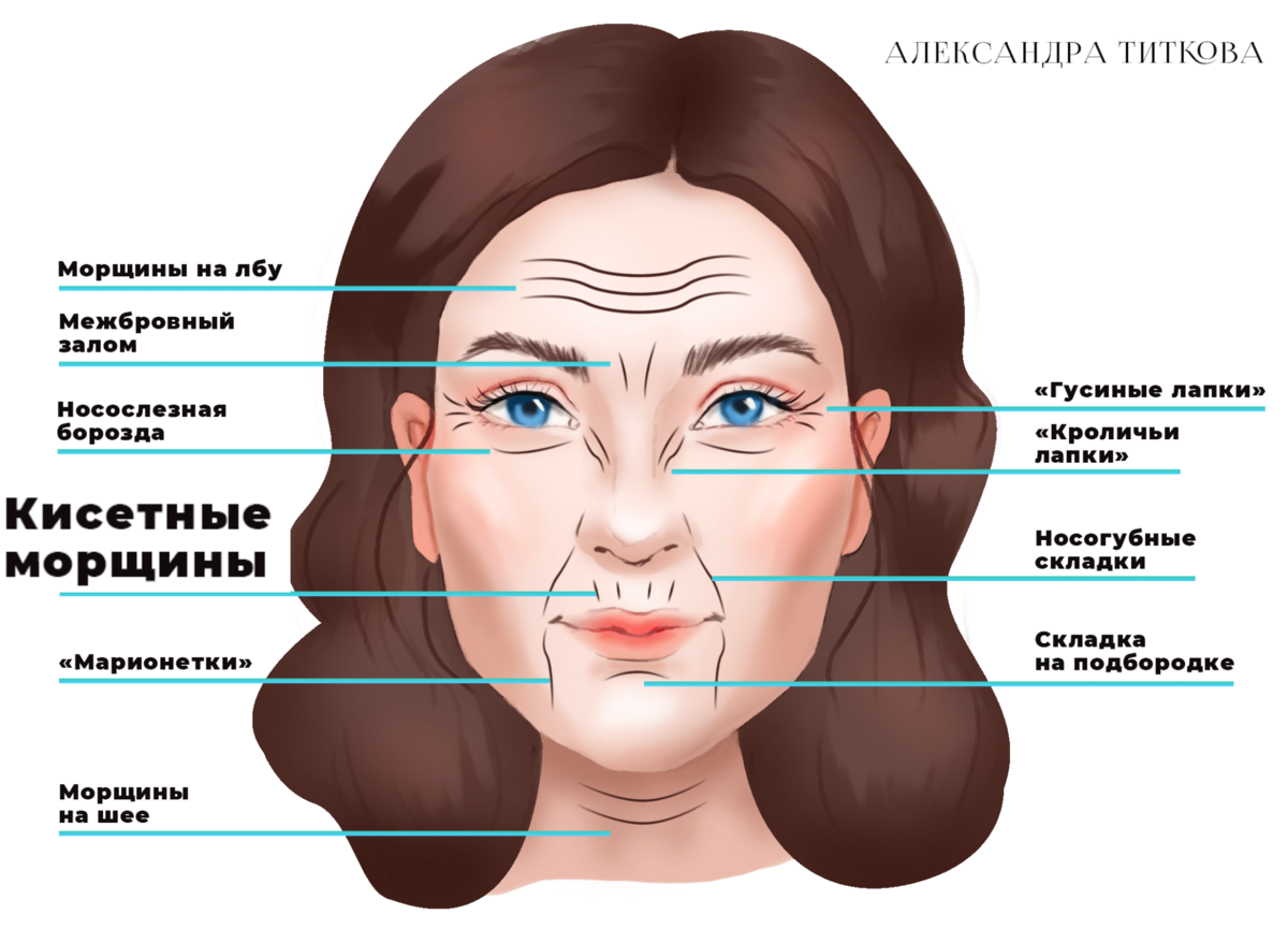 Тейпы от кисетных морщин схема