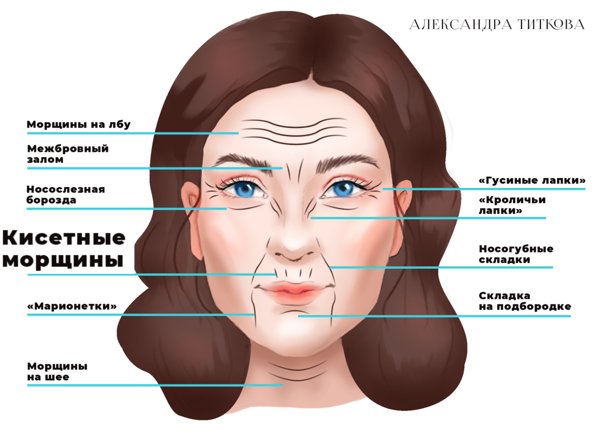 Тейпирование межбровной морщины схема