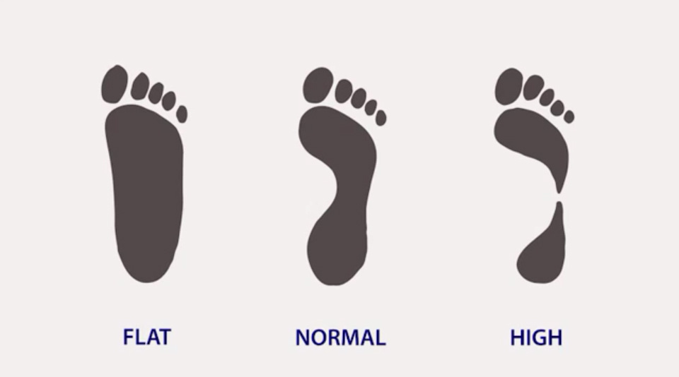 Виды пронации