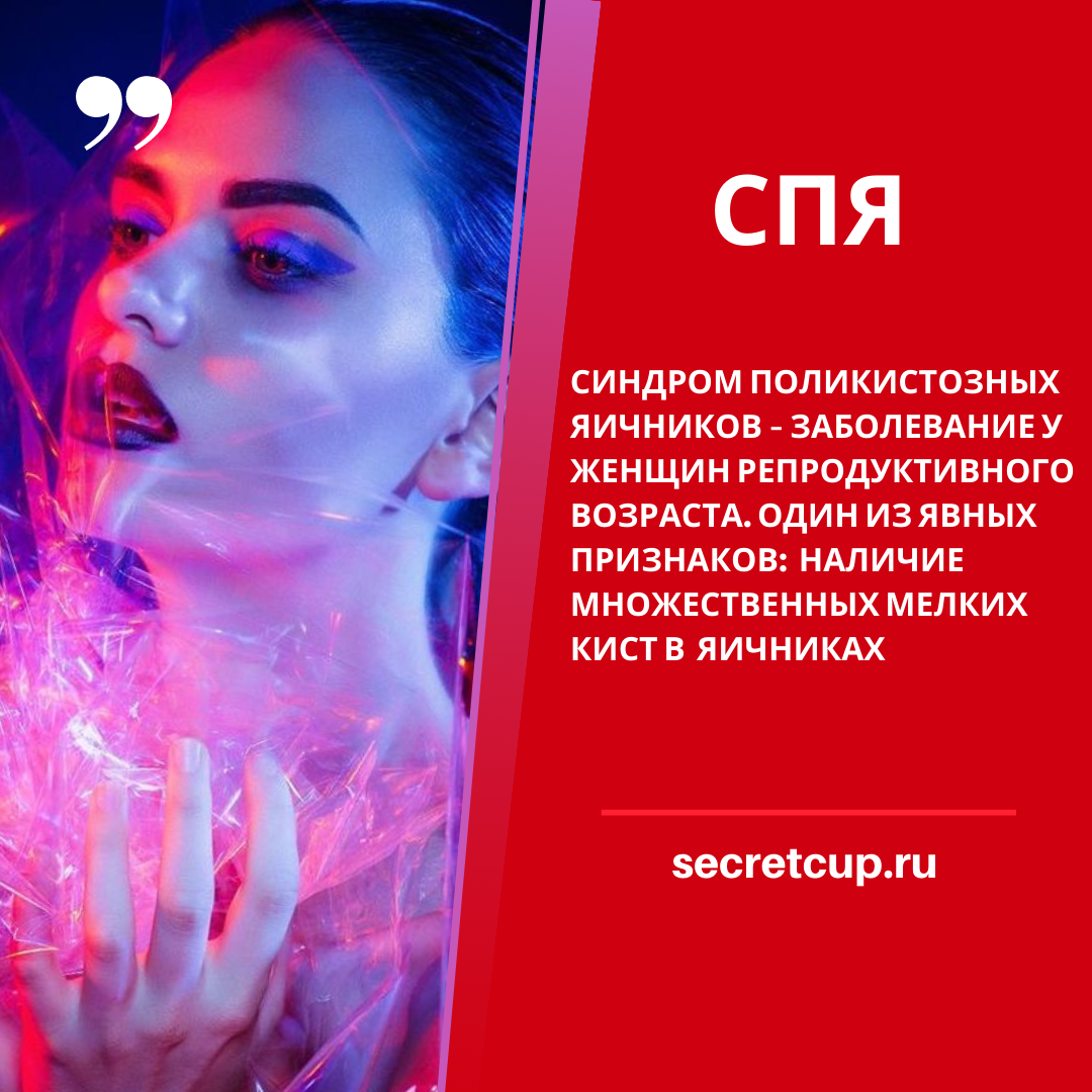  Фото принадлежит компании SECRET CUP GROUP LTD. Все права защищены.