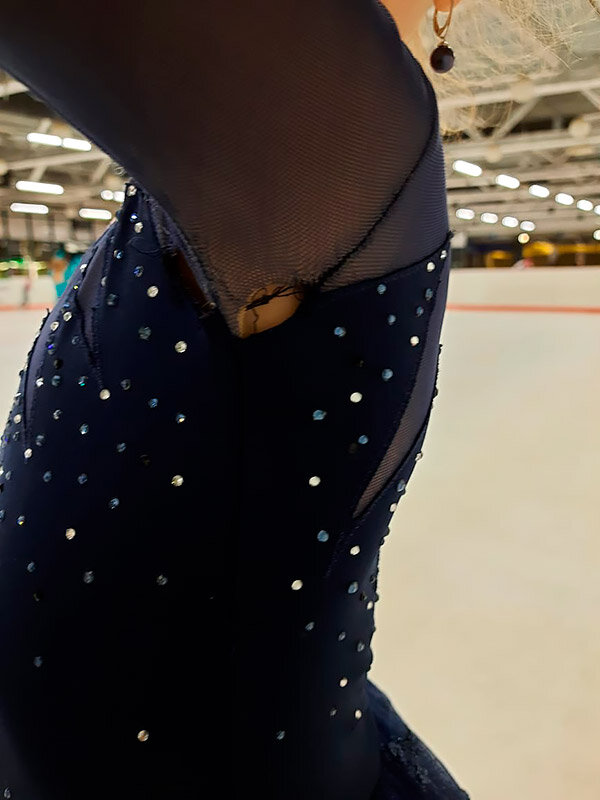 Лопнувший шов