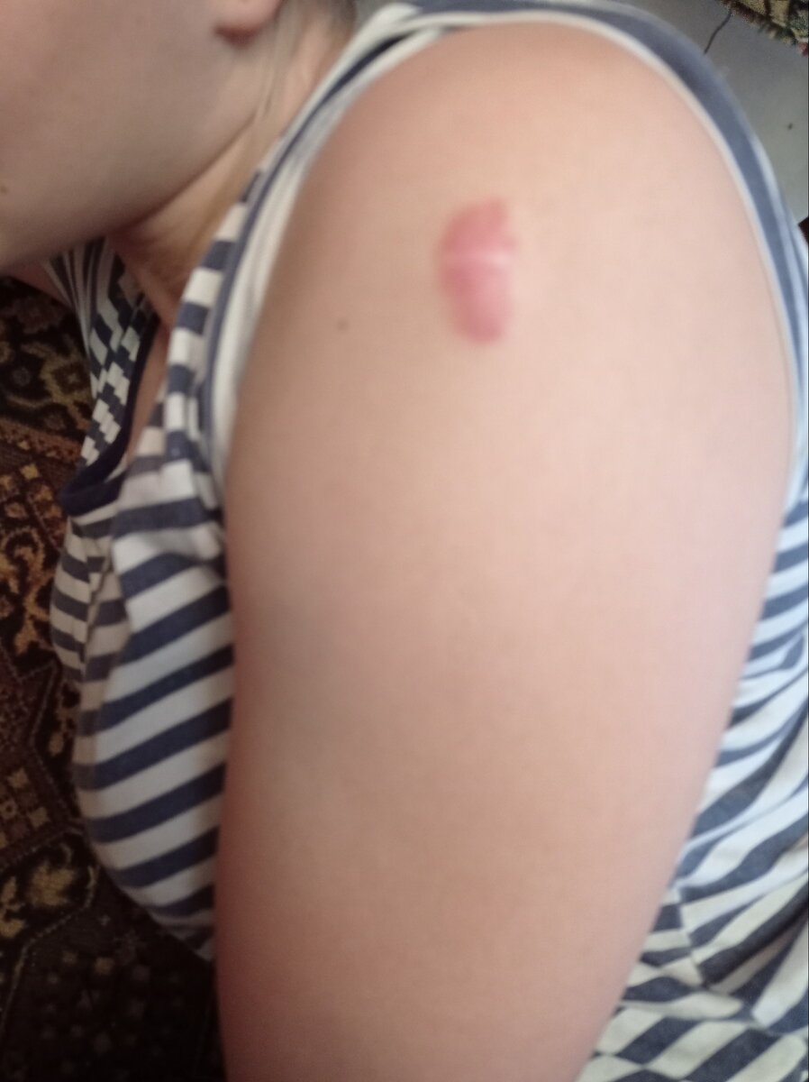 Вот такая прививка 