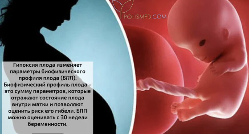 Тесты по гипоксии плода помощь матери. Профилактика внутриутробной гипоксии плода.