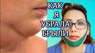 Как я убрала брыли и второй подбородок. Быстро и просто. Бандаж для лица!