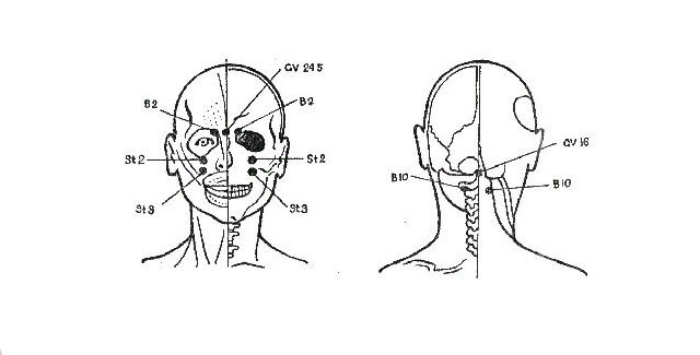 Китайский точечный массаж — активные акупунктурные точки на теле человека