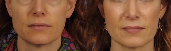  Фото из открытых источников - "Яндекс Картинки".