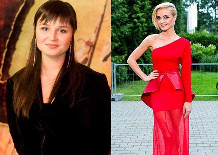 Полина гагарина до похудения и после пластики