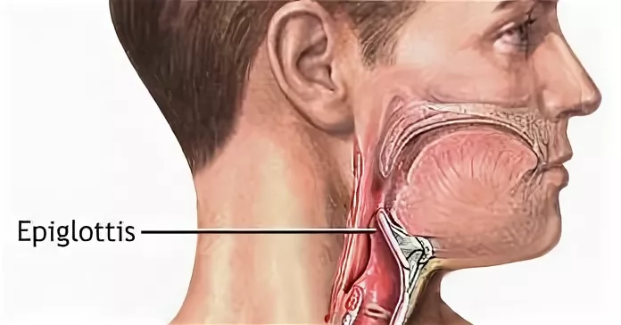 Эпиглоттит: симптомы, лечение и профилактика