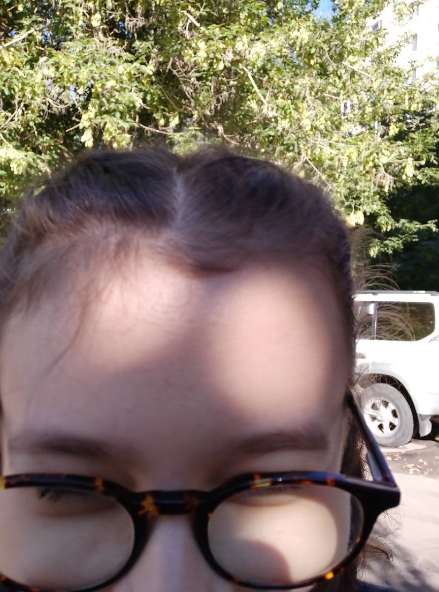 Лысый лоб)))))