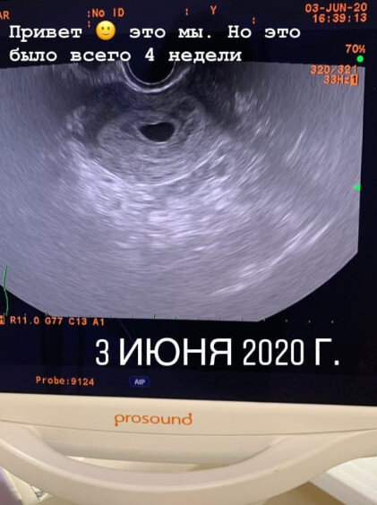 Скоро Марина станет мамой