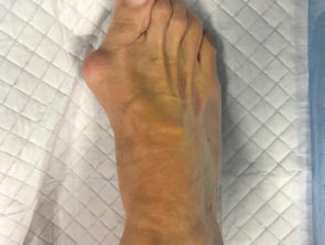 До операции