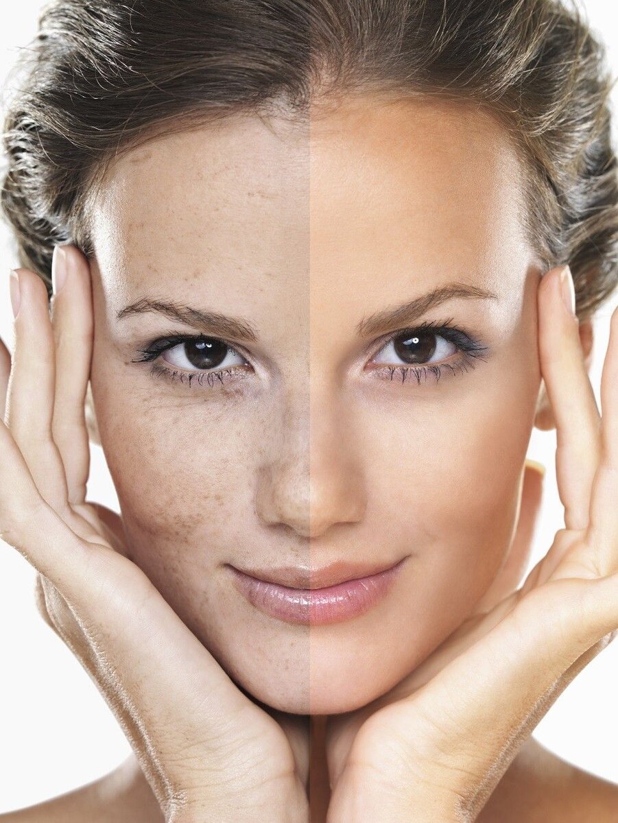 капусту с давних времен используют и в косметике(сок,измельченные и целые листья капусты,квашеная капуста и капустный рассол)