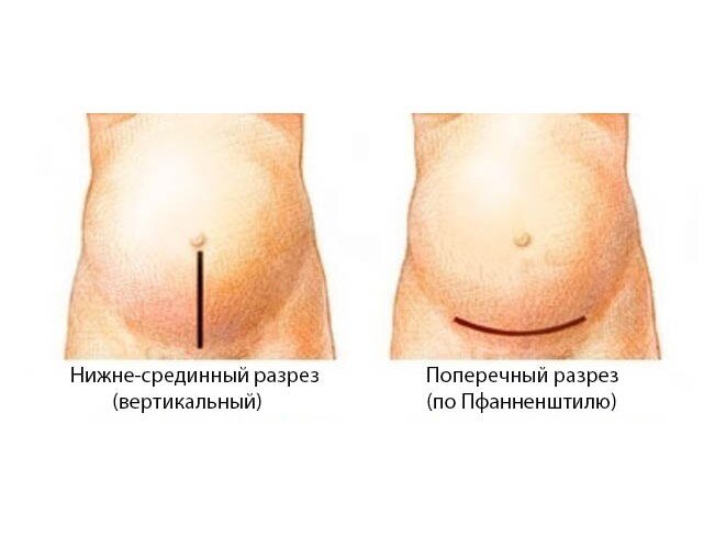 Картинка взята из открытых источников.  