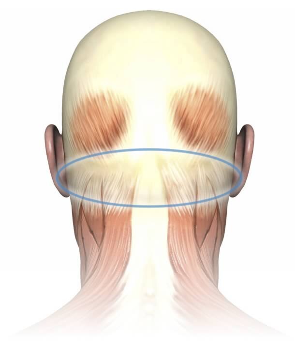 Боли в затылке (затылочной области, в задней части головы) – диагностика и лечение в Казани