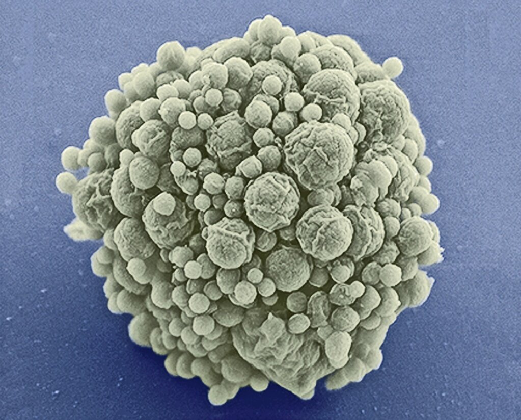 Синтетическая бактерия — Mycoplasma laboratorium JCVI-syn3.0