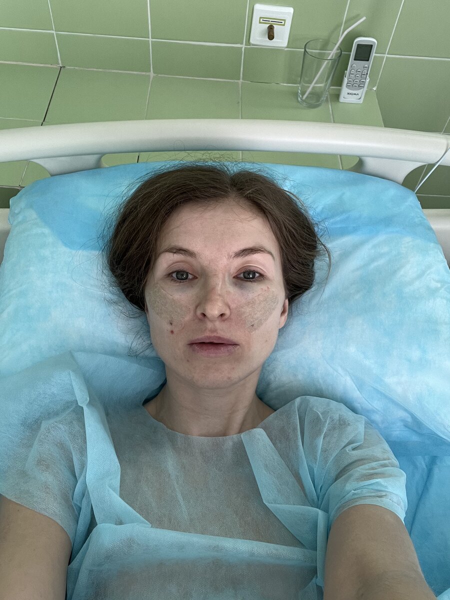 Фото сразу после операции 