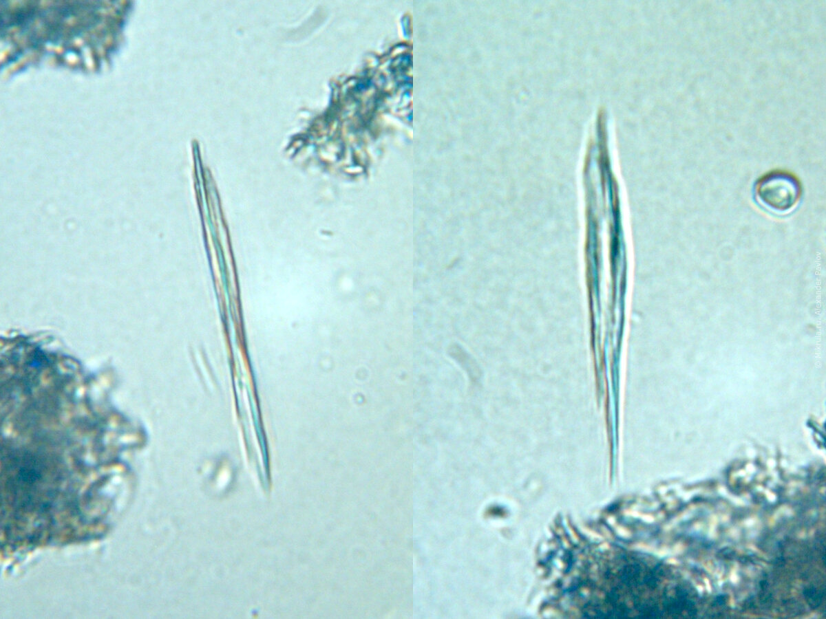 Not by the Hair of My Stemmy-stem-stem! Image of the Week - March 1. Scanning el