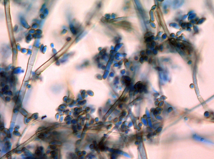 Cladosporium resinae