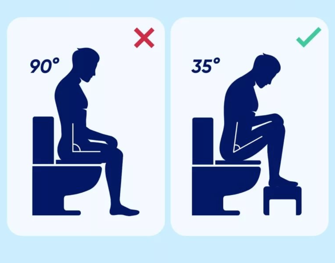 Какая сижу. Правильная поза для туалета. Поза для правильного хождения в туалет. Позы для какания. Как правильно сидеть в туалете.