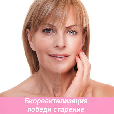 биоревитализация