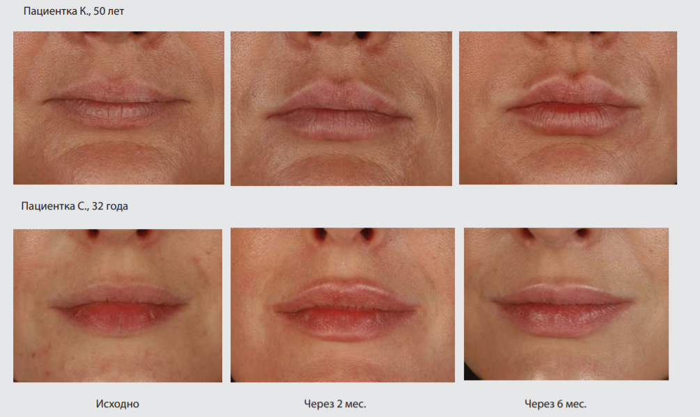 Результаты исследования