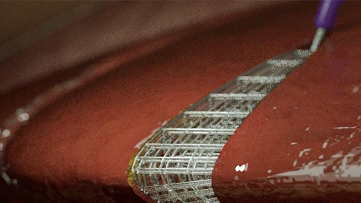 Изображение трёхмерной сетки, имплантированной в мягкие ткани живого организма. Иллюстрация Terasaki Institute.