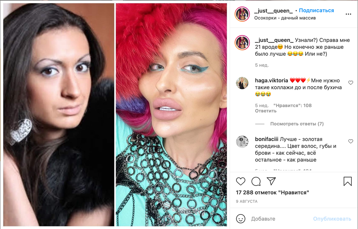 Anastasia Pokreshchuk, Instagram model with world’s biggest cheeks