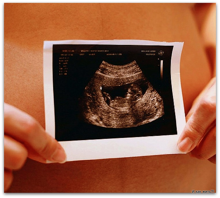 Первое фото