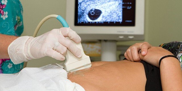 Рисунок  1 - Проведение УЗИ брюшной полости