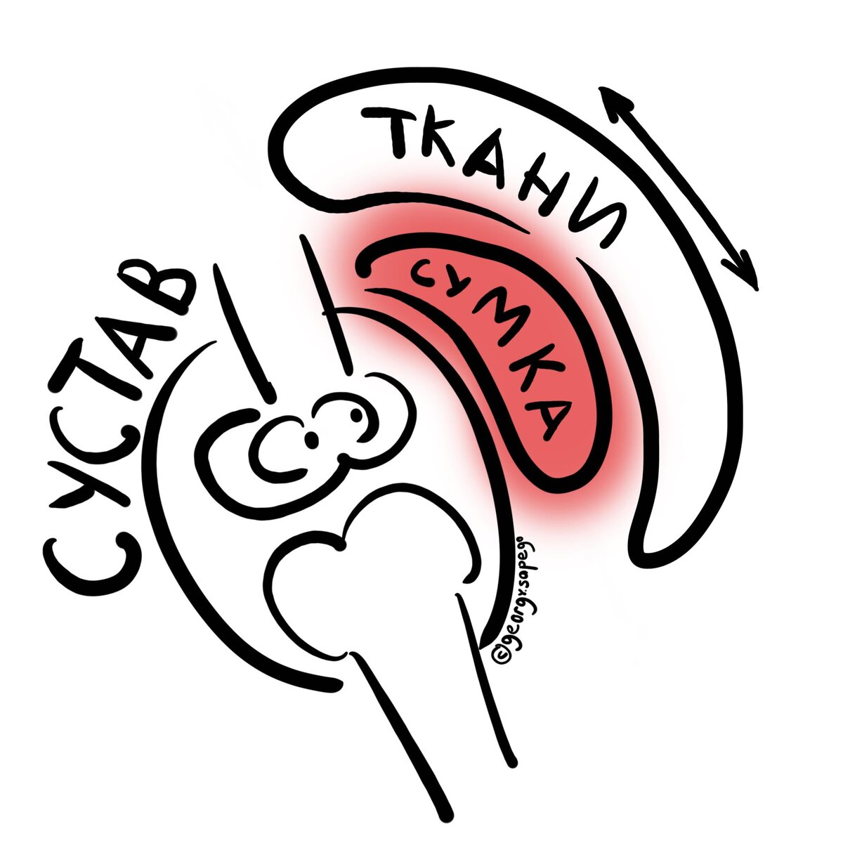 Бурсит, который называют коленом домработницы. Чтобы понять его ...