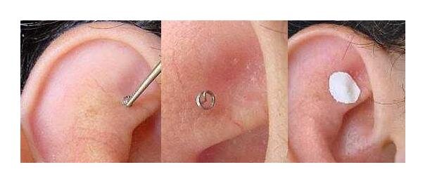 Вот так выглядела та сама иголочка. Только место установки у меня было другое.