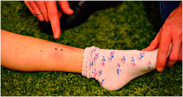 источник https://yandex.ru/images/search?from=tabbar&text=что%20делать%20если%20ребенка%20укусила%20змея&p=4&pos=137&rpt=simage&img_url=https%3A%2F%2Fgkb11-chel.ru%2Fwp-content%2Fuploads%2F2019%2F10%2F82422ac0a7a6c825d1fda201cd8daaae.jpg