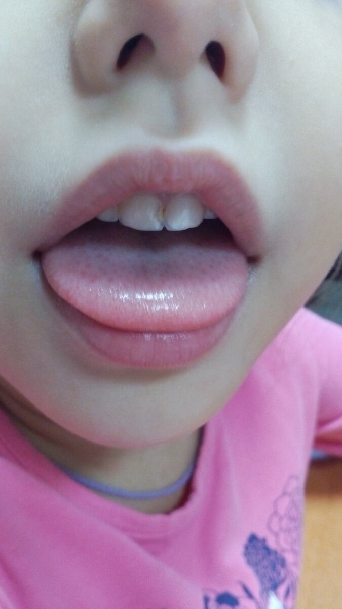 Упражнение "Блин"