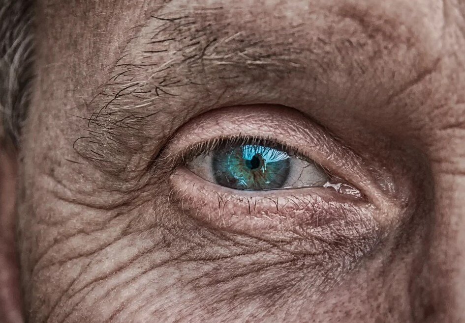 https://pixabay.com/ru/photos/%D0%BA%D0%BE%D0%B6%D0%B0-%D0%B3%D0%BB%D0%B0%D0%B7-%D0%B0%D0%B9%D1%80%D0%B8%D1%81-%D1%81%D0%B8%D0%BD%D0%B8%D0%B9-%D0%B1%D0%BE%D0%BB%D0%B5%D0%B5-%D1%81%D1%82%D0%B0%D1%80%D1%8B%D0%B5-3358873/